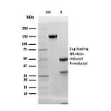 SDS-PAGE - Anti-Adiponectin Antibody [ADPN/4256] - BSA and Azide free (A253797) - Antibodies.com