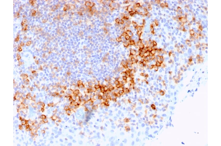 Immunohistochemistry - Anti-CD27 Antibody [LPFS2/1611] - BSA and Azide free (A253799) - Antibodies.com