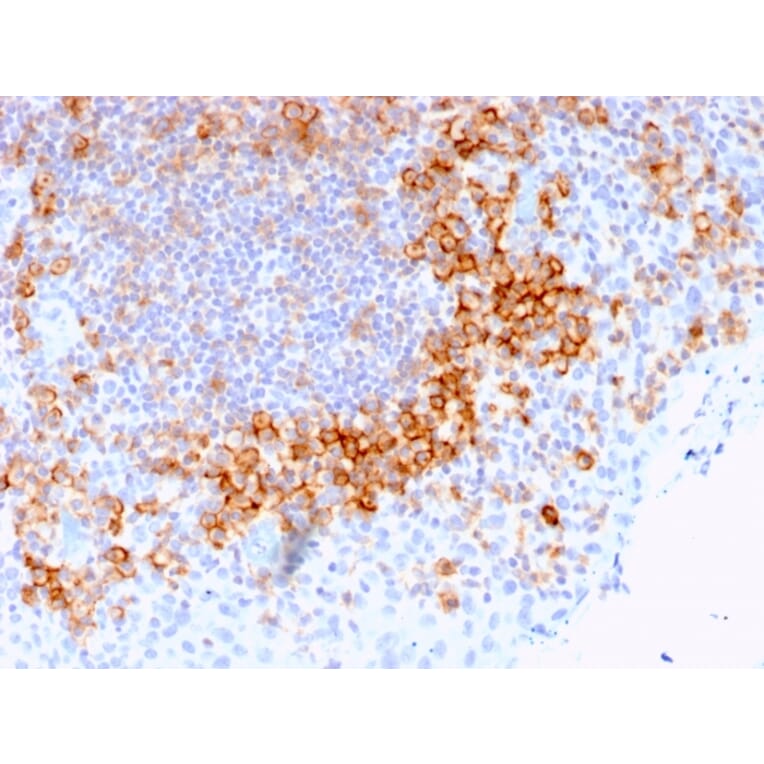 Immunohistochemistry - Anti-CD27 Antibody [LPFS2/1611] - BSA and Azide free (A253799) - Antibodies.com