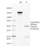 SDS-PAGE - Anti-CD27 Antibody [LPFS2/1611] - BSA and Azide free (A253799) - Antibodies.com