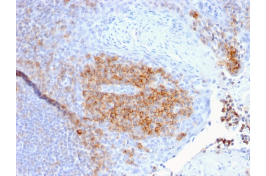 Immunohistochemistry - Anti-CD27 Antibody [LPFS2/1611] - BSA and Azide free (A253799) - Antibodies.com