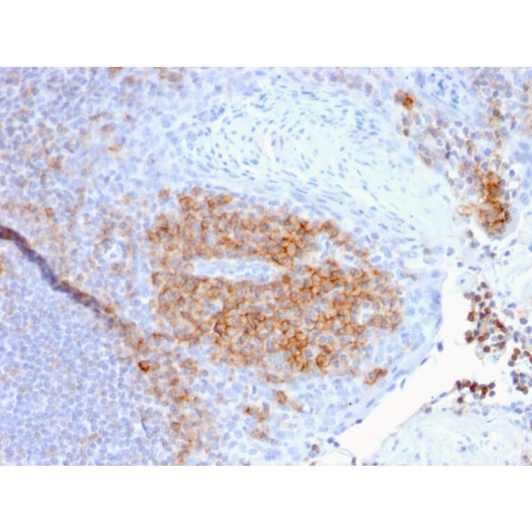 Immunohistochemistry - Anti-CD27 Antibody [LPFS2/1611] - BSA and Azide free (A253799) - Antibodies.com