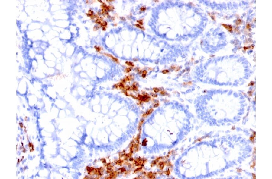 Immunohistochemistry - Anti-CD27 Antibody [LPFS2/1611] - BSA and Azide free (A253799) - Antibodies.com