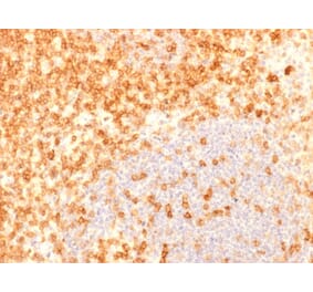 Immunohistochemistry - Anti-CD27 Antibody [rLPFS2/1611] - BSA and Azide free (A253800) - Antibodies.com