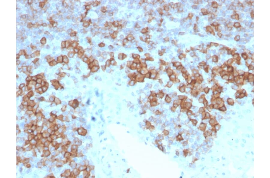 Immunohistochemistry - Anti-CD27 Antibody [LPFS2/4177] - BSA and Azide free (A253801) - Antibodies.com