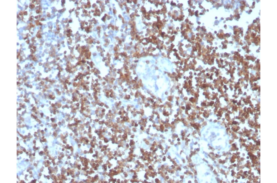 Immunohistochemistry - Anti-CD27 Antibody [LPFS2/4177] - BSA and Azide free (A253801) - Antibodies.com