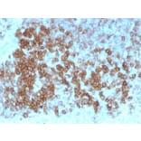 Immunohistochemistry - Anti-CD27 Antibody [LPFS2/4179] - BSA and Azide free (A253802) - Antibodies.com