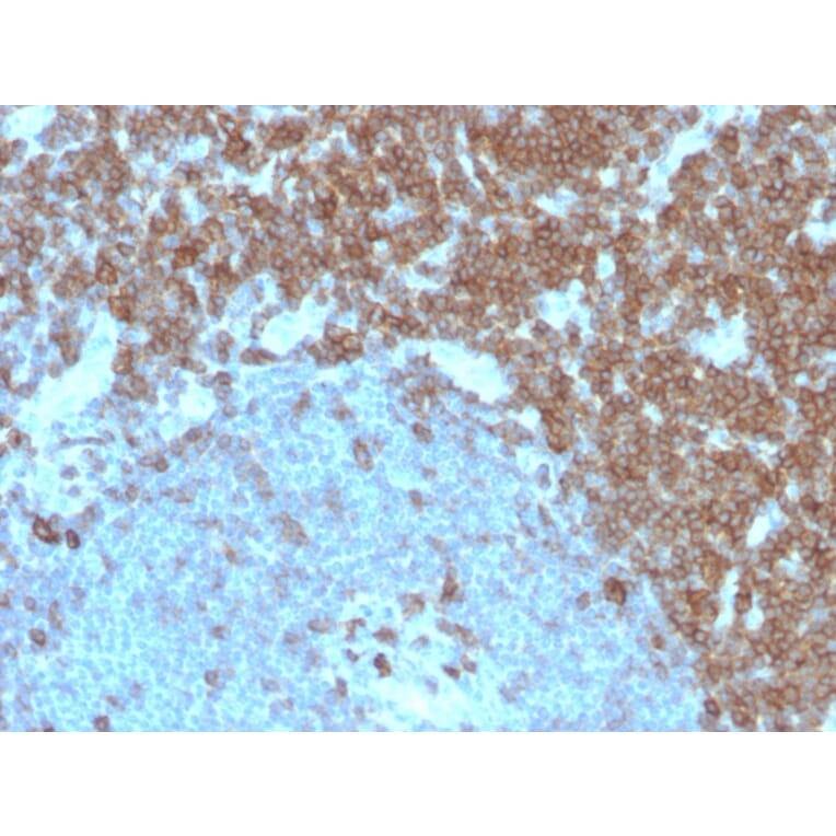 Immunohistochemistry - Anti-CD27 Antibody [LPFS2/4179] - BSA and Azide free (A253802) - Antibodies.com