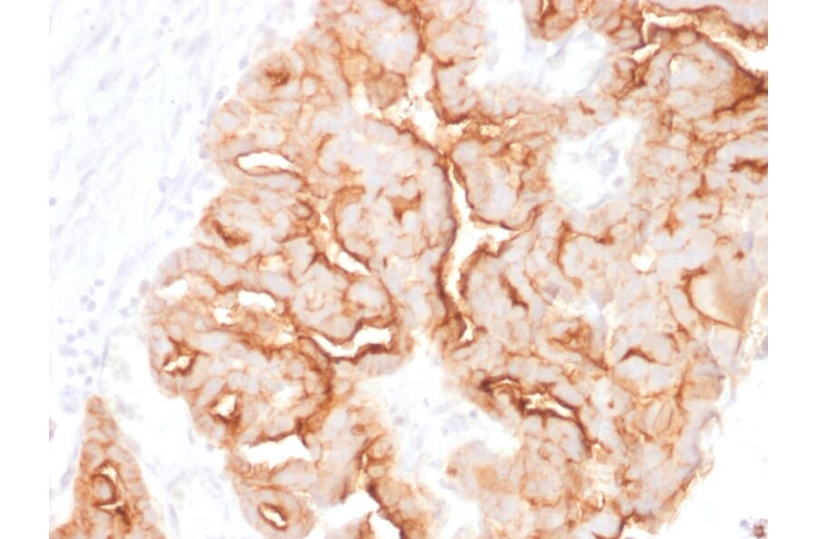 Immunohistochemistry - Anti-MUC16 Antibody [MUC16/1860] - BSA and Azide free (A253803) - Antibodies.com
