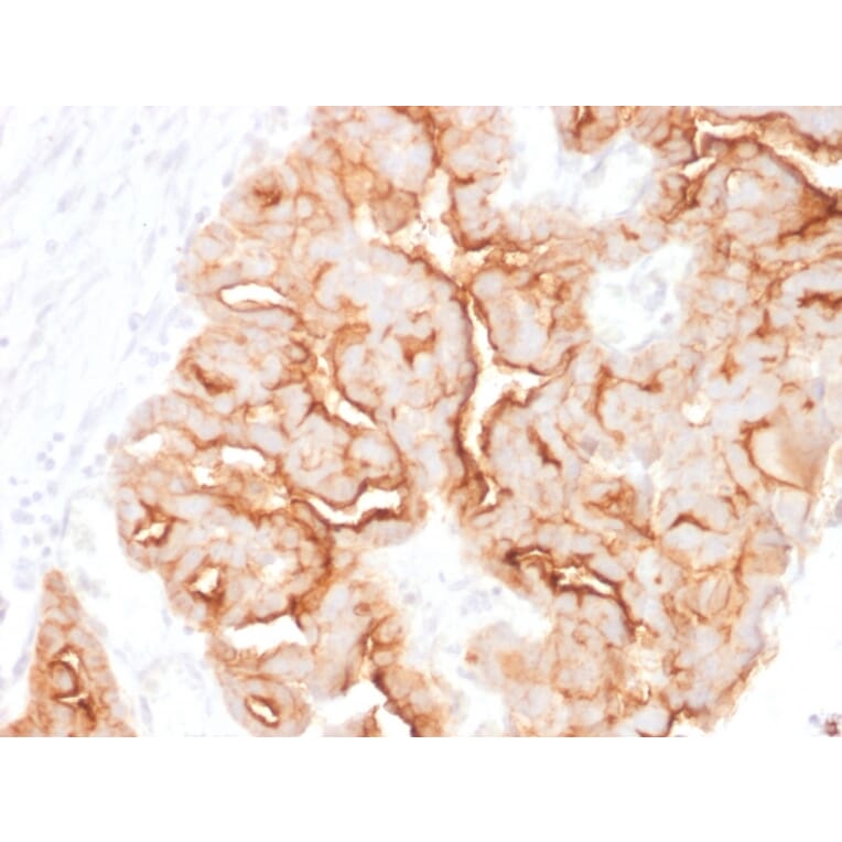 Immunohistochemistry - Anti-MUC16 Antibody [MUC16/1860] - BSA and Azide free (A253803) - Antibodies.com
