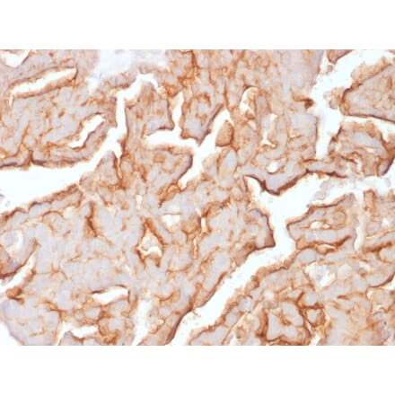 Immunohistochemistry - Anti-MUC16 Antibody [OCA125/1900] - BSA and Azide free (A253804) - Antibodies.com