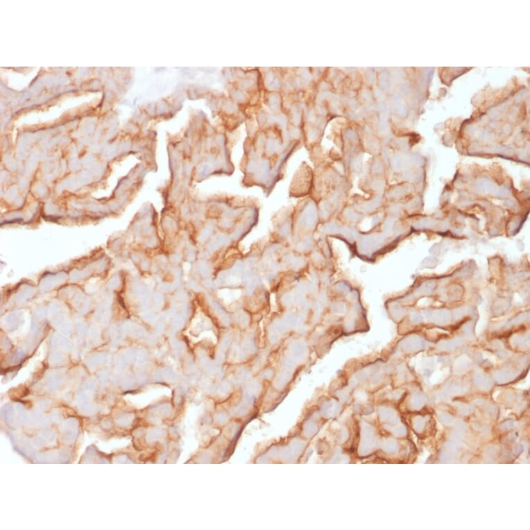 Immunohistochemistry - Anti-MUC16 Antibody [OCA125/1900] - BSA and Azide free (A253804) - Antibodies.com