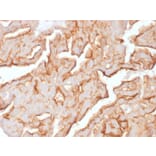 Immunohistochemistry - Anti-MUC16 Antibody [OCA125/1900] - BSA and Azide free (A253804) - Antibodies.com