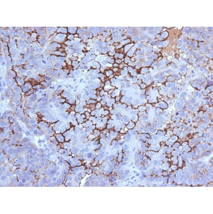 Immunohistochemistry - Anti-MUC16 Antibody [5E11] - BSA and Azide free (A253805) - Antibodies.com