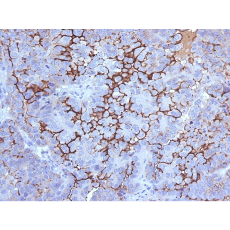 Immunohistochemistry - Anti-MUC16 Antibody [5E11] - BSA and Azide free (A253805) - Antibodies.com
