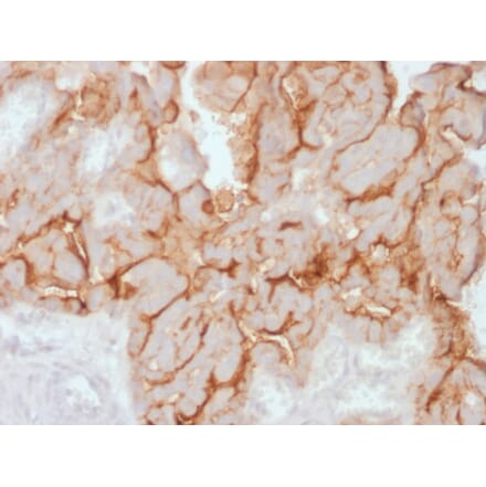Immunohistochemistry - Anti-MUC16 Antibody [OCA125/2349R] - BSA and Azide free (A253807) - Antibodies.com