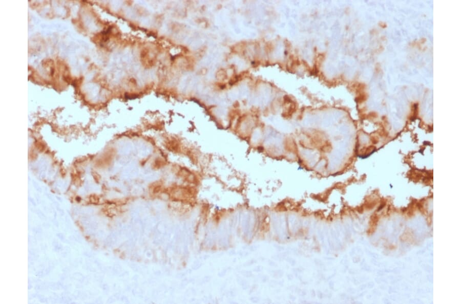 Immunohistochemistry - Anti-MUC16 Antibody [OCA125/2349R] - BSA and Azide free (A253806) - Antibodies.com