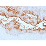 Immunohistochemistry - Anti-MUC16 Antibody [OCA125/2349R] - BSA and Azide free (A253806) - Antibodies.com