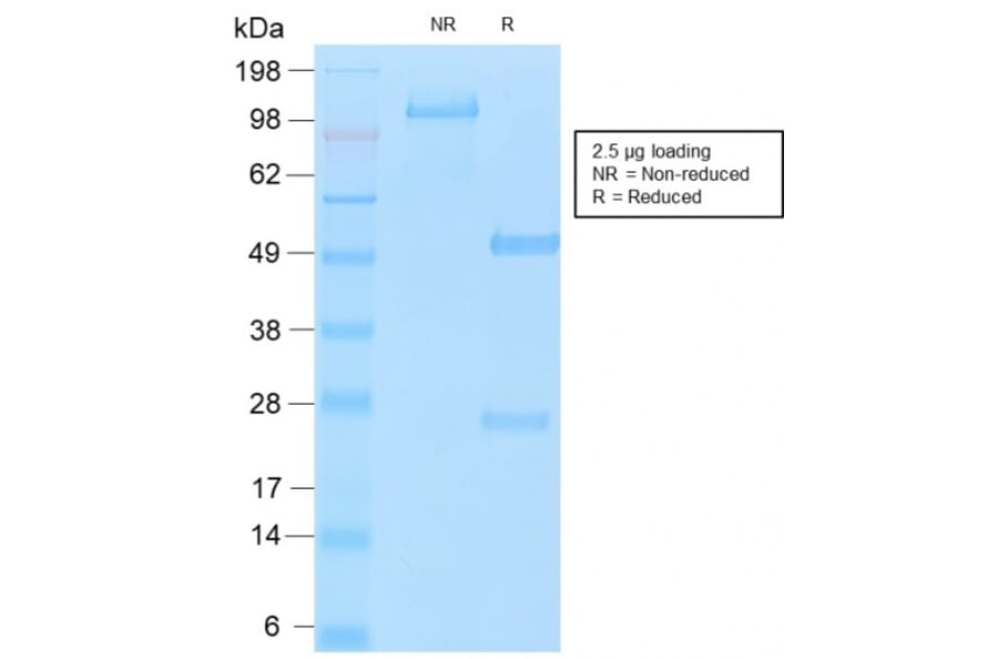 SDS-PAGE - Anti-MUC16 Antibody [OCA125/2349R] - BSA and Azide free (A253807) - Antibodies.com