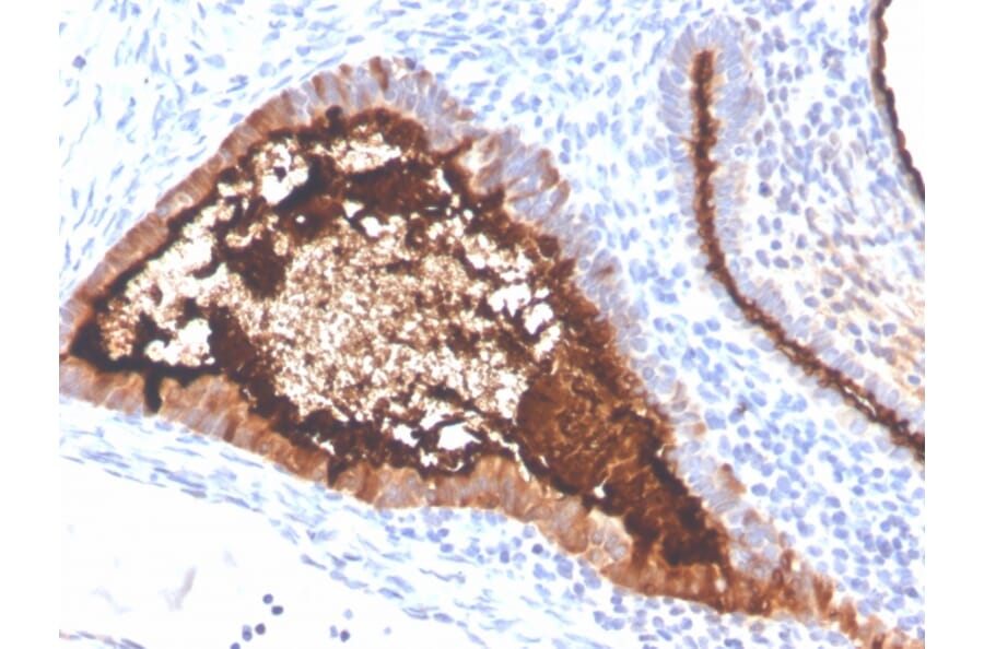Immunohistochemistry - Anti-MUC16 Antibody [OCA125/4505R] - BSA and Azide free (A253808) - Antibodies.com
