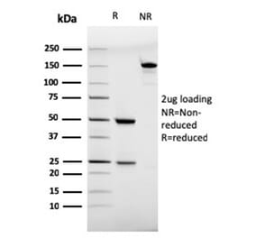 SDS-PAGE - Anti-CD28 Antibody [C28/75] - BSA and Azide free (A253810) - Antibodies.com