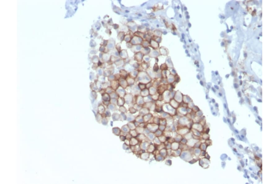 Immunohistochemistry - Anti-CD86 Antibody [C86/3711] - BSA and Azide free (A253821) - Antibodies.com