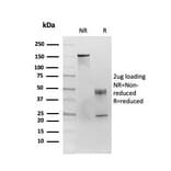 SDS-PAGE - Anti-CD86 Antibody [C86/3713] - BSA and Azide free (A253822) - Antibodies.com