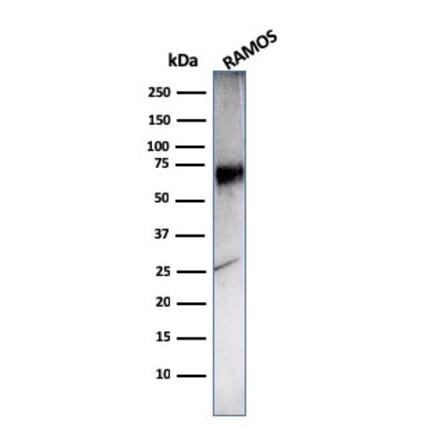 Western Blot - Anti-CD86 Antibody [C86/3716] - BSA and Azide free (A253823) - Antibodies.com