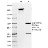 SDS-PAGE - Anti-CD86 Antibody [BU63] - BSA and Azide free (A253824) - Antibodies.com