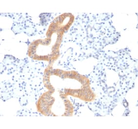 Immunohistochemistry - Anti-CD86 Antibody [SPM600] - BSA and Azide free (A253826) - Antibodies.com