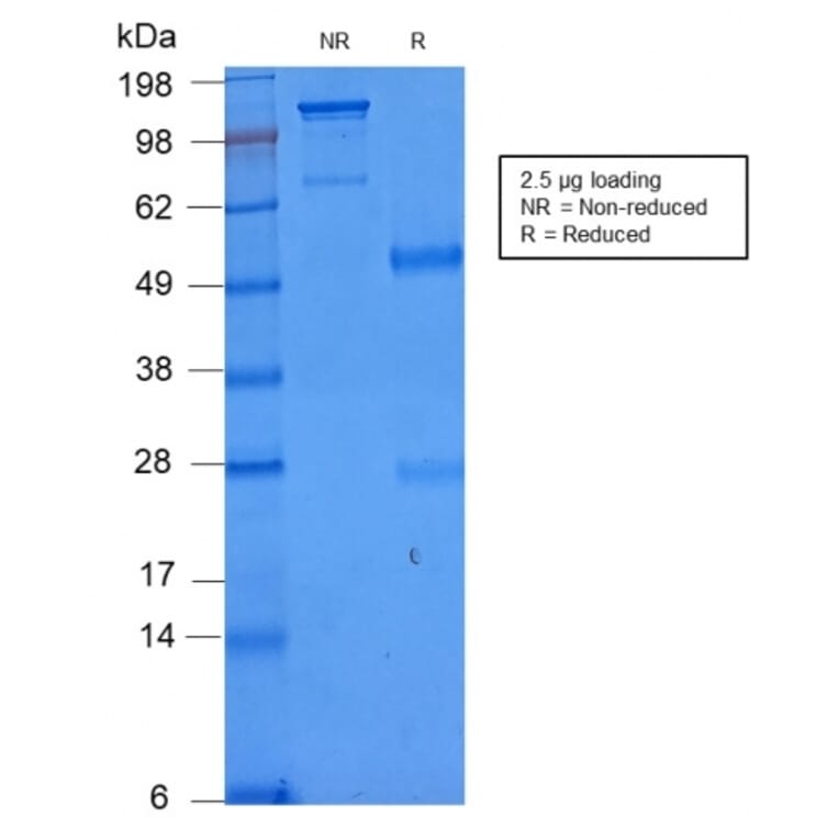 SDS-PAGE - Anti-NULL Antibody [C86/2160R] - BSA and Azide free (A253828) - Antibodies.com