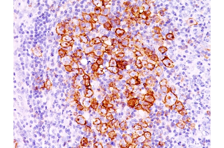 Immunohistochemistry - Anti-CD30 Antibody [CD30/412] - BSA and Azide free (A253828) - Antibodies.com