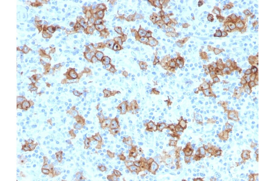 Immunohistochemistry - Anti-CD30 Antibody [Ki-1/779] - BSA and Azide free (A253829) - Antibodies.com