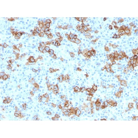 Immunohistochemistry - Anti-CD30 Antibody [Ki-1/779] - BSA and Azide free (A253829) - Antibodies.com