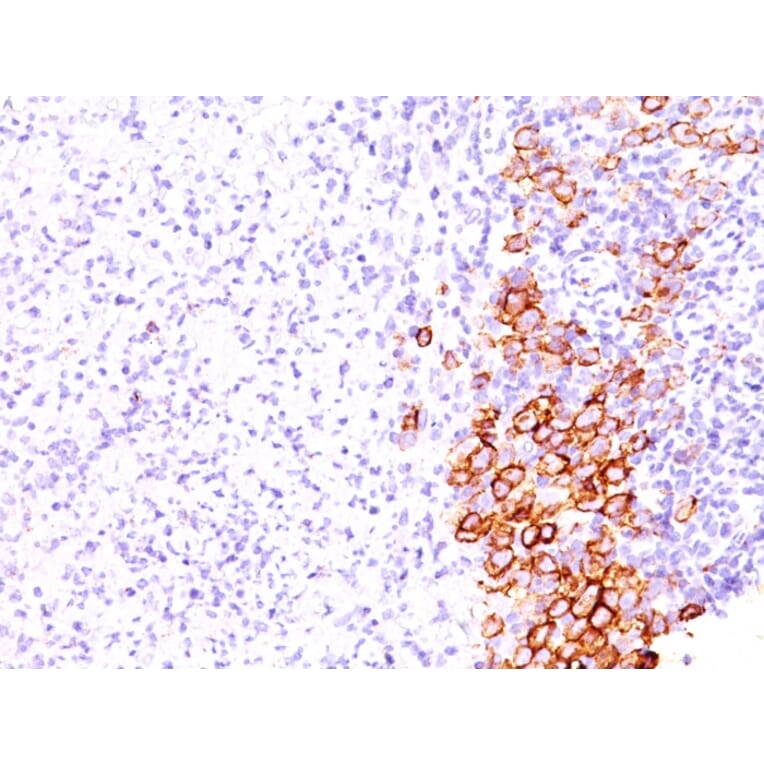 Immunohistochemistry - Anti-CD30 Antibody [SPM609] - BSA and Azide free (A253830) - Antibodies.com