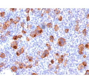 Immunohistochemistry - Anti-CD30 Antibody [rKi-1/779] - BSA and Azide free (A253831) - Antibodies.com