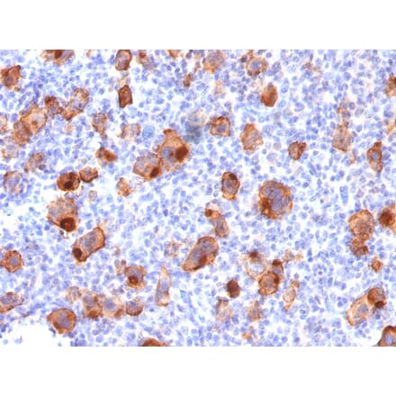 Immunohistochemistry - Anti-CD30 Antibody [rKi-1/779] - BSA and Azide free (A253831) - Antibodies.com