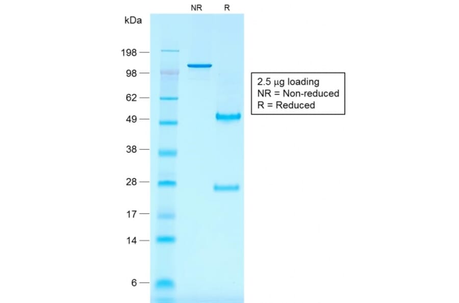 SDS-PAGE - Anti-CD30 Antibody [rKi-1/779] - BSA and Azide free (A253832) - Antibodies.com