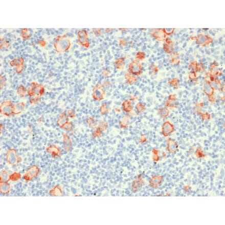 Immunohistochemistry - Anti-CD30 Antibody [rCD30/412] - BSA and Azide free (A253832) - Antibodies.com
