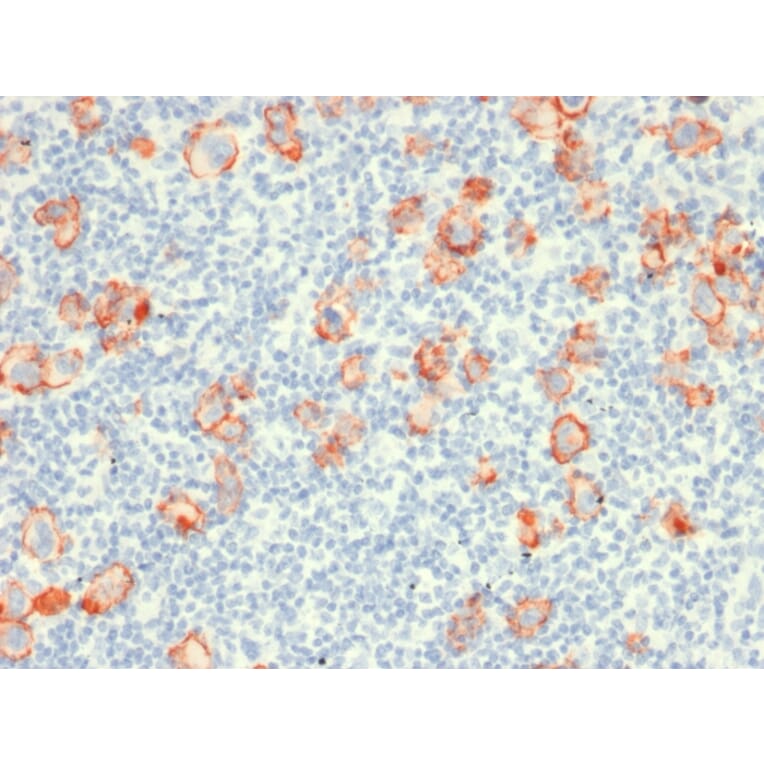 Immunohistochemistry - Anti-CD30 Antibody [rCD30/412] - BSA and Azide free (A253832) - Antibodies.com