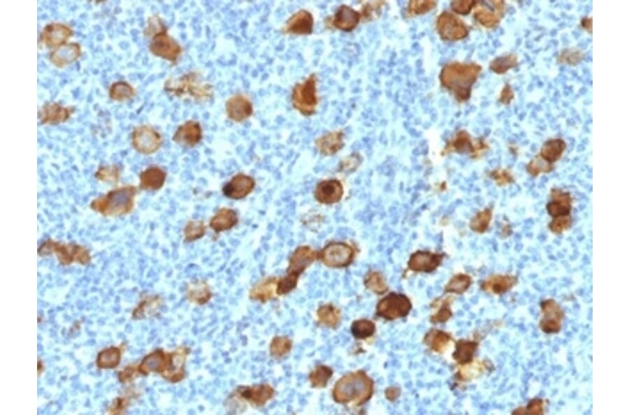 Immunohistochemistry - Anti-CD30 Antibody [Ki-1/4399R] - BSA and Azide free (A253833) - Antibodies.com