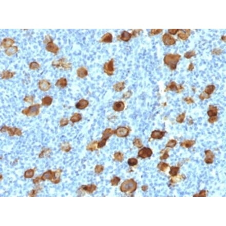 Immunohistochemistry - Anti-CD30 Antibody [Ki-1/4399R] - BSA and Azide free (A253833) - Antibodies.com