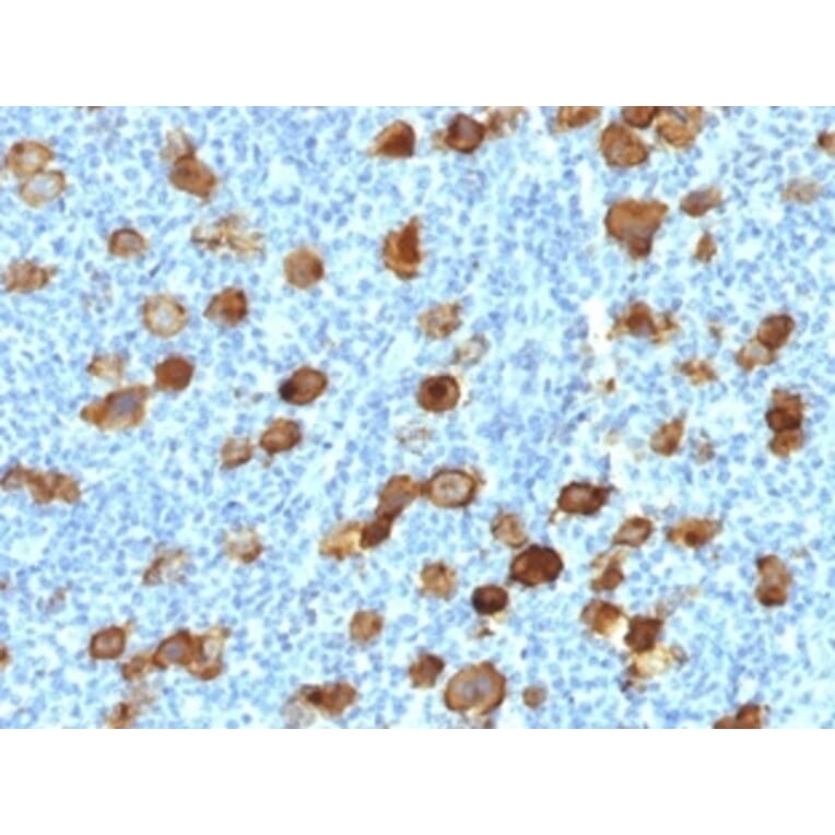 Immunohistochemistry - Anti-CD30 Antibody [Ki-1/4399R] - BSA and Azide free (A253833) - Antibodies.com