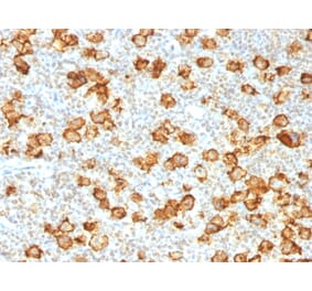 Immunohistochemistry - Anti-CD30 Antibody [Ki-1/1505R] - BSA and Azide free (A253834) - Antibodies.com