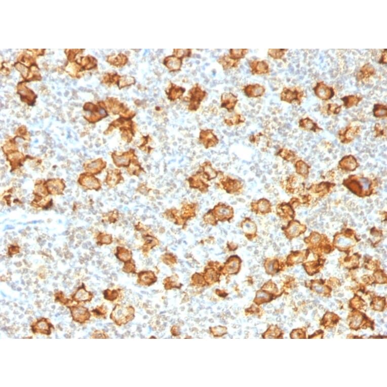 Immunohistochemistry - Anti-CD30 Antibody [Ki-1/1505R] - BSA and Azide free (A253834) - Antibodies.com