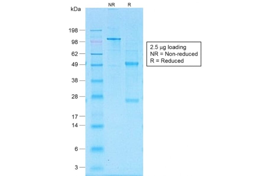 SDS-PAGE - Anti-CD30 Antibody [Ki-1/1505R] - BSA and Azide free (A253835) - Antibodies.com