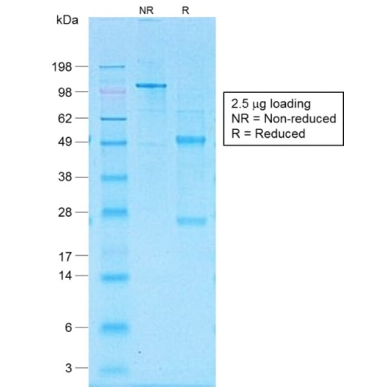 SDS-PAGE - Anti-CD30 Antibody [Ki-1/1505R] - BSA and Azide free (A253835) - Antibodies.com