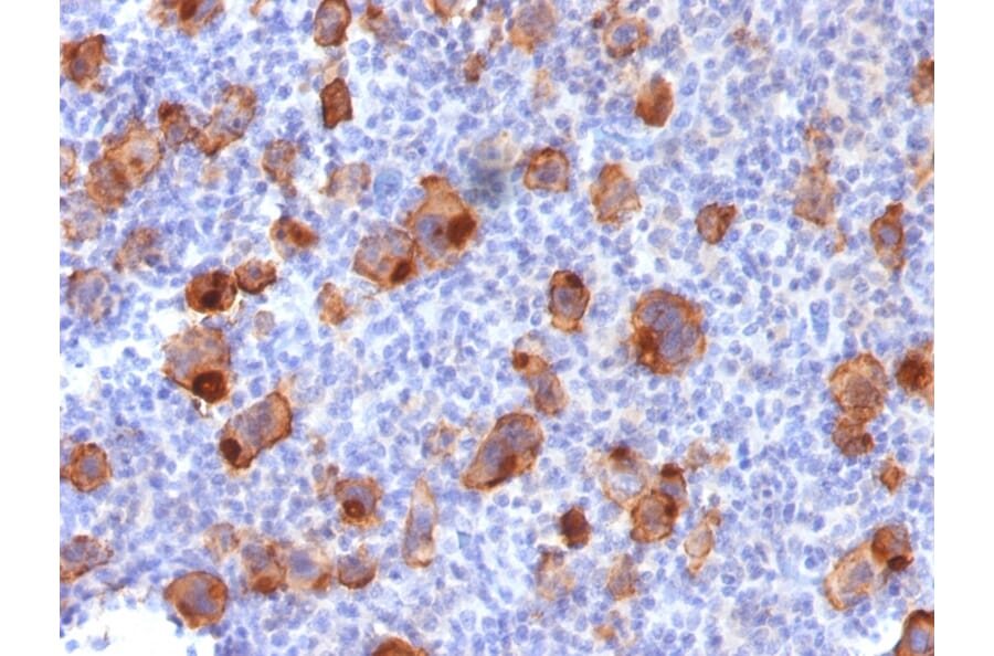 Immunohistochemistry - Anti-CD30 Antibody [Ki-1/1747R] - BSA and Azide free (A253835) - Antibodies.com