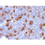 Immunohistochemistry - Anti-CD30 Antibody [Ki-1/1747R] - BSA and Azide free (A253835) - Antibodies.com