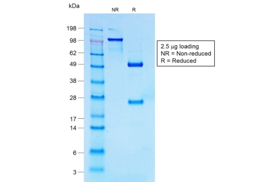 SDS-PAGE - Anti-CD30 Antibody [Ki-1/1747R] - BSA and Azide free (A253836) - Antibodies.com